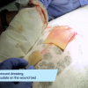 video-thumb-0